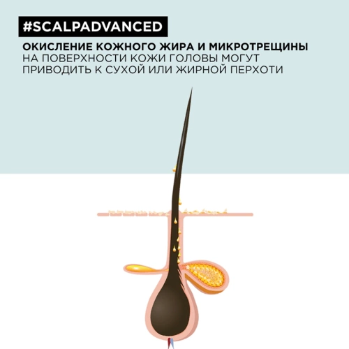 Шампунь от перхоти / SCALP ADVANCED 300 мл фото 5